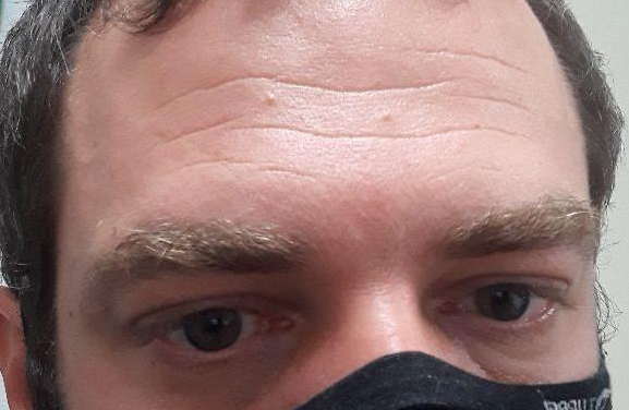 Del malestar en la globalització a l’auge de l’extrema dreta (I). El neoliberalisme i el feixisme postmodern.